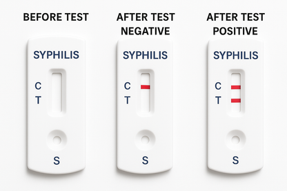 Syphilis test results display: before test, negative, and positive cassettes