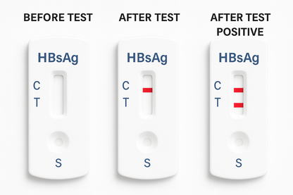 Three HBsAg rapid test cassettes: before test, after negative, after positive