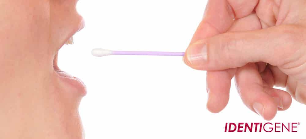Cheek swab being used inside a mouth with a purple collection swab