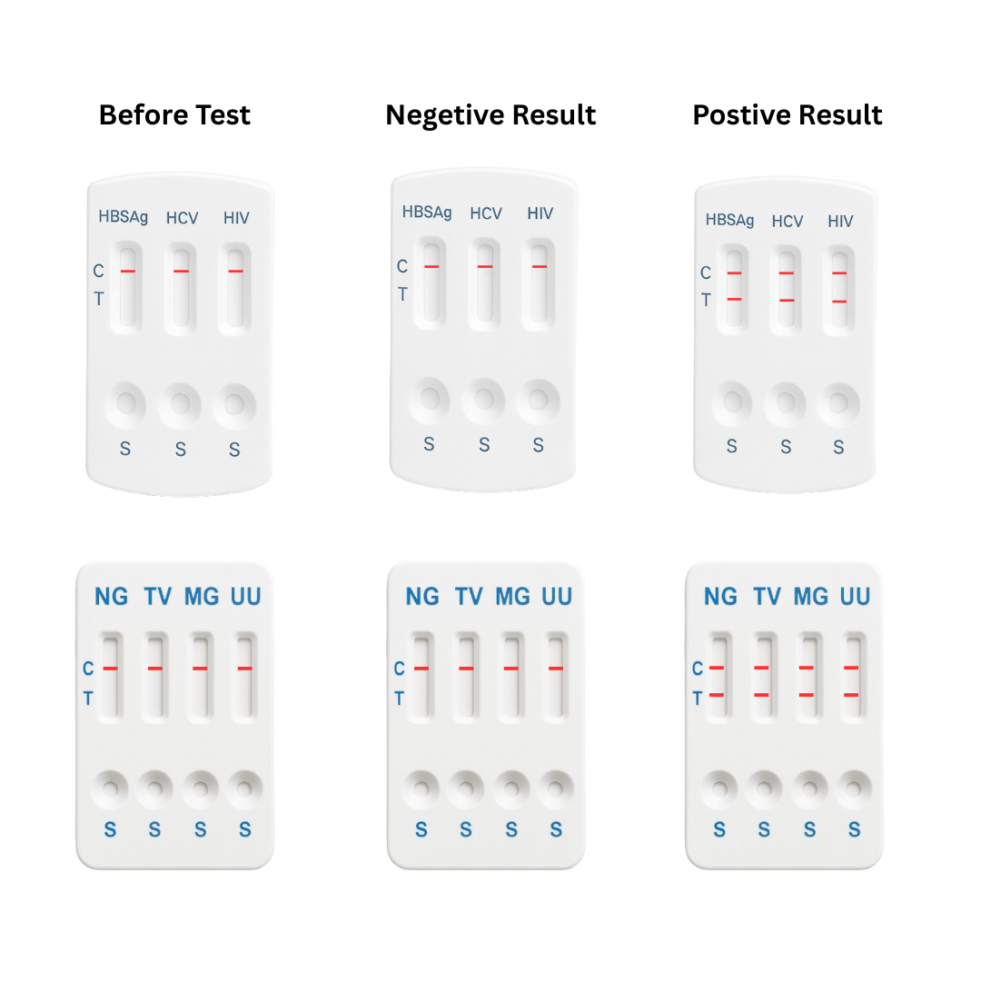 11 panel STD test cards showing before, negative, and positive results