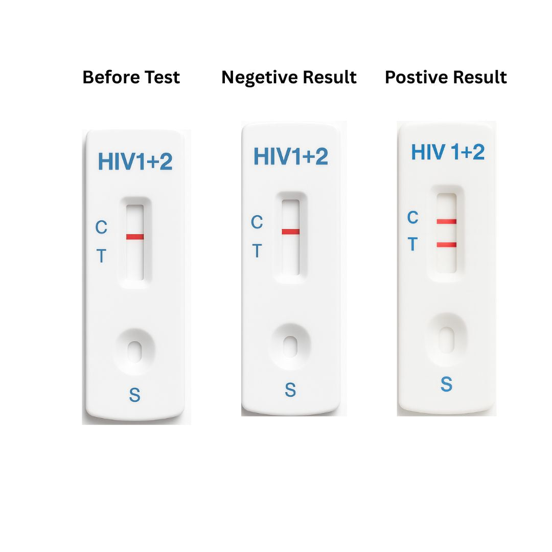 HIV test cassette cards showing before, negative, and positive C/T lines