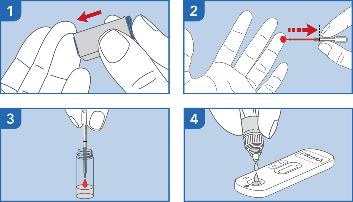 Step-by-step instructions for using an HIV 1/2 self-test device with blood sample